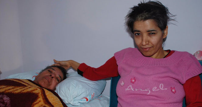 Yatalak anneye engelli kızı bakıyor