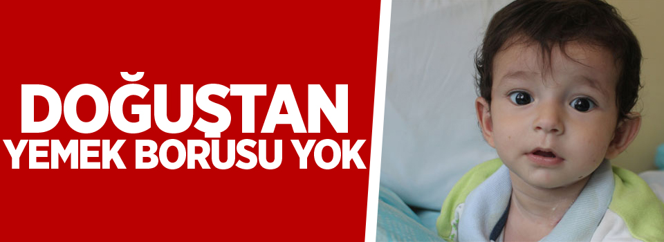 Doğuştan yemek borusu yok