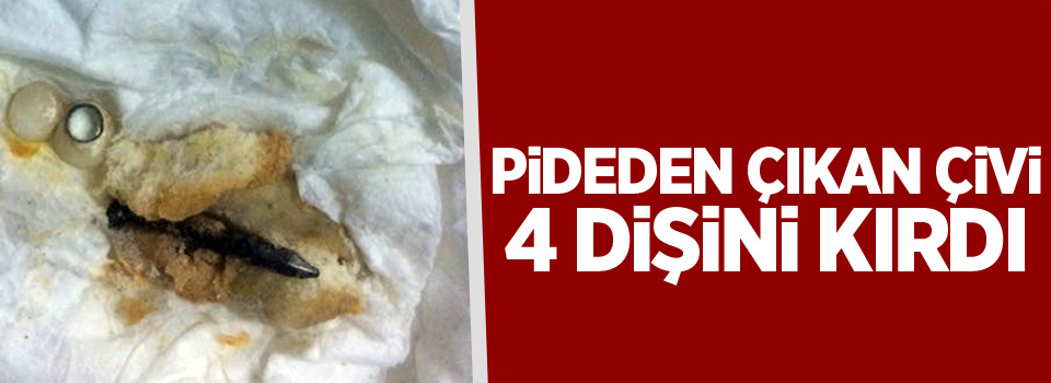 Pideden çıkan çivi 4 dişini kırdı