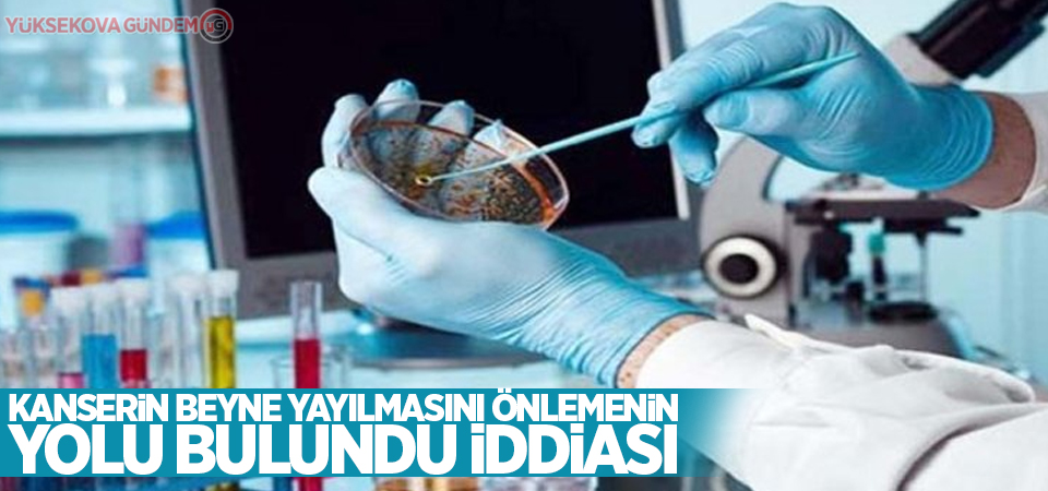 Kanserin beyne yayılmasını önlemenin yolu bulundu iddiası