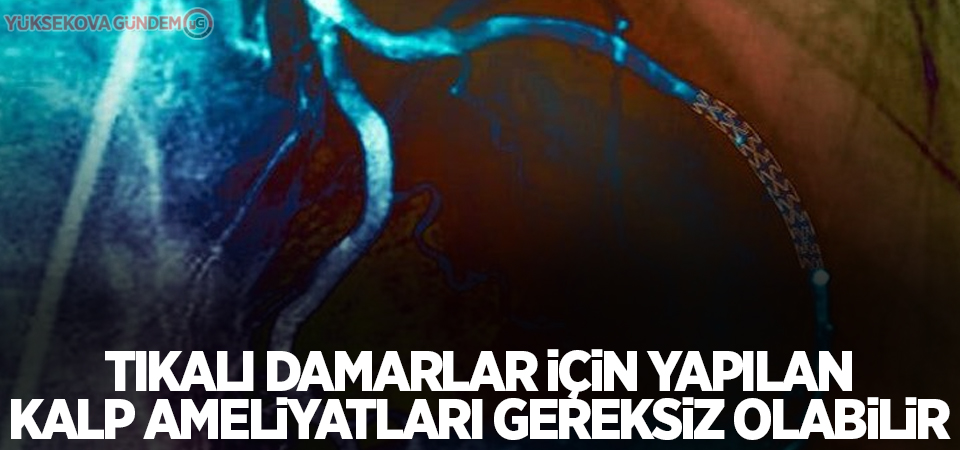 Tıkalı damarlar için yapılan kalp ameliyatları gereksiz olabilir