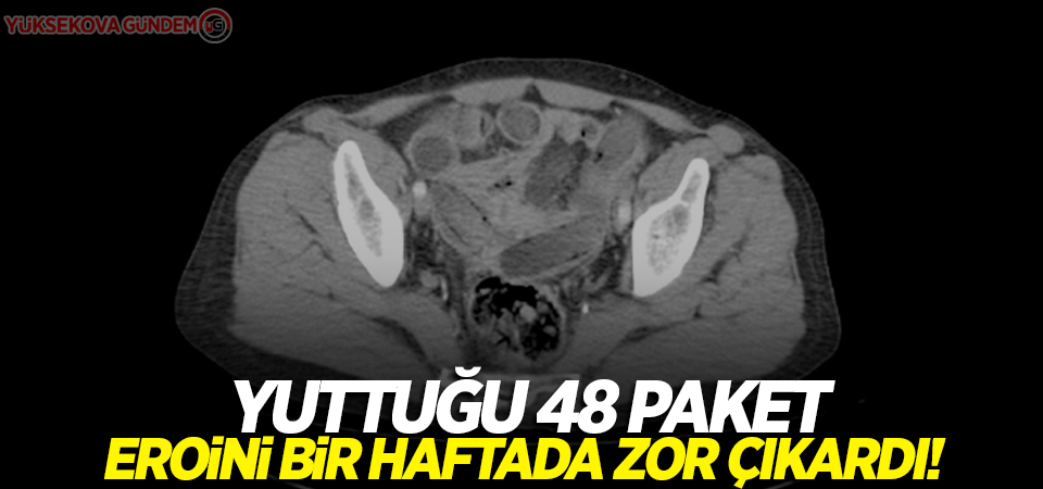 Yuttuğu 48 paket eroini bir haftada zor çıkardı!