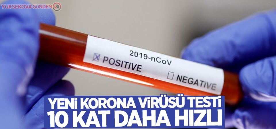 Yeni korona virüsü testi 10 kat daha hızlı