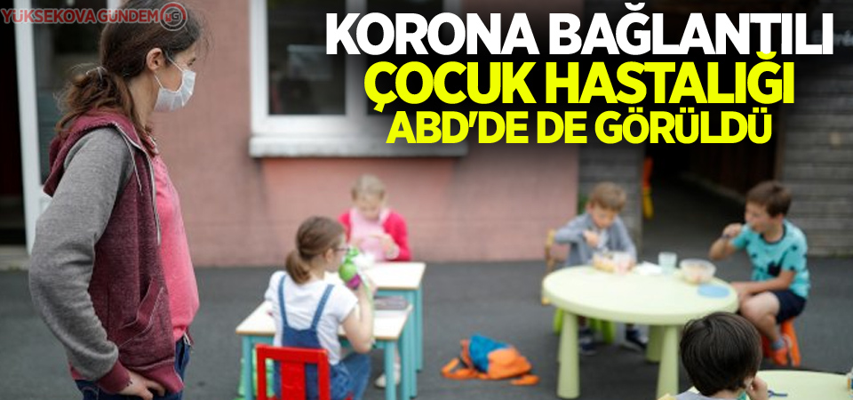 Korona bağlantılı çocuk hastalığı ABD'de de görüldü