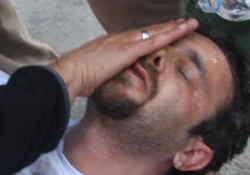 iki gazeteci yaralandı