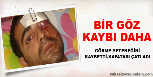 Bir Göz Kaybı Daha