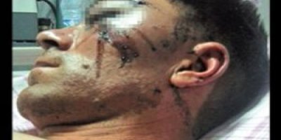 Polis bu kez komalık etti