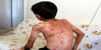 Şeker Toplayan Çocuklara İşkence