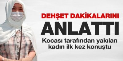 Kocası tarafında yakılan kadın dehşet anını anlattı