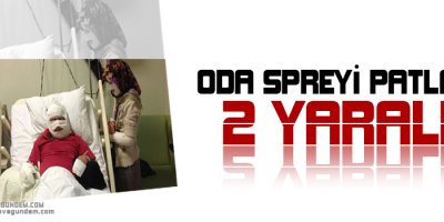 Oda spreyi patladı, karı-koca bu hale geldi