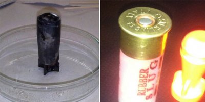 12 yaşındaki Nihat Kazanhanı öldüren cisim ne?