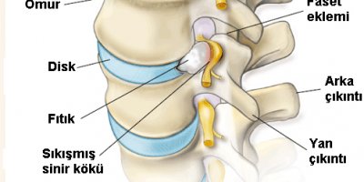 Ameliyat yerine şekerli su