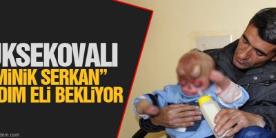Minik Serkan yüz nakli bekliyor