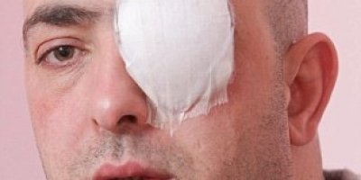 Sevgilisinin Yanında Gözünü Çıkardılar