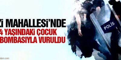 Gazi Mahallesinde 14 yaşındaki çocuk gaz bombasıyla vuruldu