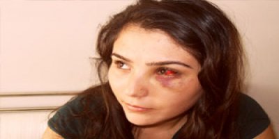 'Gözüme copla vurdular'