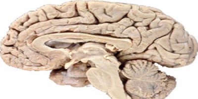 Dünyanın en büyük beyin koleksiyonu 'bozuldu'