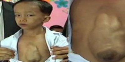 Muhammed'in kalbi dışarda atıyor