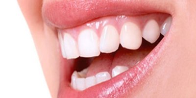 Diş eti kanamaları hafife alınmamalı