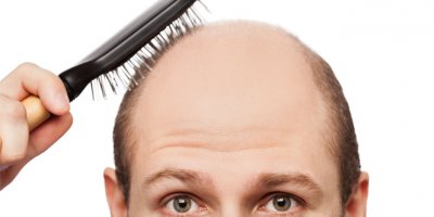 Saç seyrelmesine dikkat