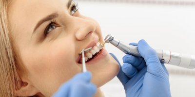 Sık diş beyazlatma dişte kararma ve doku kaybı yapıyor