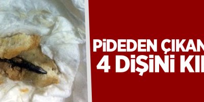 Pideden çıkan çivi 4 dişini kırdı