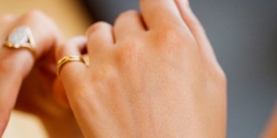 Şems Arslan'dan egzama kremi