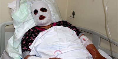 Temizlik yaparken dikkatsizlik kadını bu hale getirdi