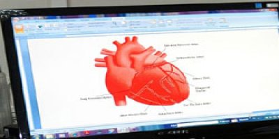 Ritim bozukluklarına ''dondurarak'' tedavi