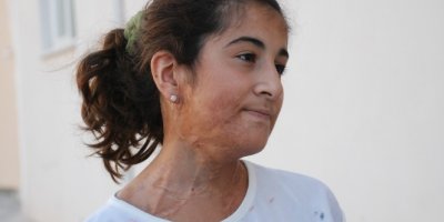 12 yaşında, 13 ameliyat oldu