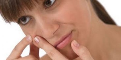 Bu Sivilce İlacını Kullananlar Dikkat