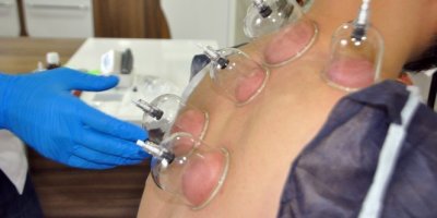 Doktordan hacamat uyarısı