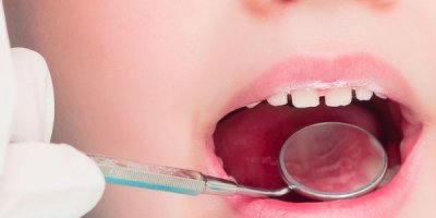 Dişleri güçlendiren besinler