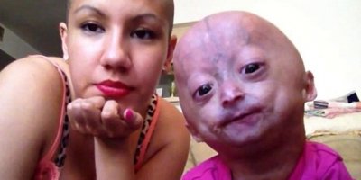 13 yaşına geldiğinde ölecek