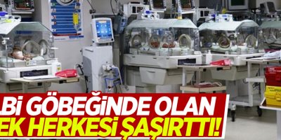 Kalbi göbeğinde olan bebek herkesi şaşırttı!