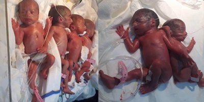 Irak'ta bir ilk, yediz dünyaya getirdi