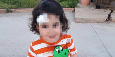 Sokak köpeği 1,5 yaşındaki çocuğa saldırdı