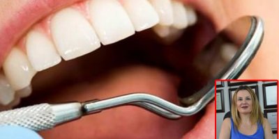 Düzenli diş tedavisi Alzheimer riskini azaltıyor