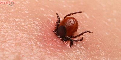 Kene tarafından ısırılan genç öldü