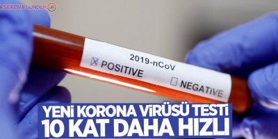 Yeni korona virüsü testi 10 kat daha hızlı