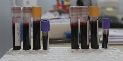 Korona virüs kan bağışlarını yüzde 75 düşürdü