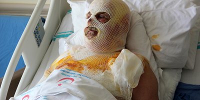 Sobada çay yapmak istedi, az daha canından oluyordu