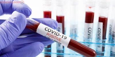 İran'da korona salgında rekor vaka sayısı