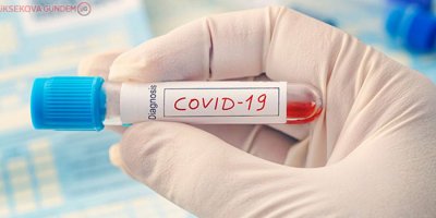 İsveç'te korona virüs için yeni hızlı test geliştirildi