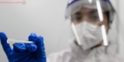 Fransa'da son 24 saatte 22 bin 180 yeni koronavirüs vakası