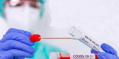 İngiltere'de Covid-19'a karşı yeni bir aşı testi başlıyor