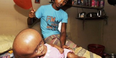 18 aylık bebeğin büyük dramı