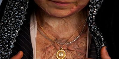 4 ayda 150 kadın kendini yaktı