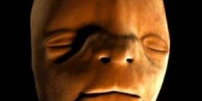 İnsan yüzünün anne karnındaki oluşumu