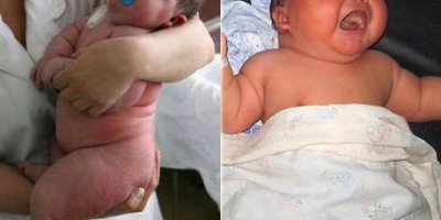 8 kilo 700 gramlık bebek